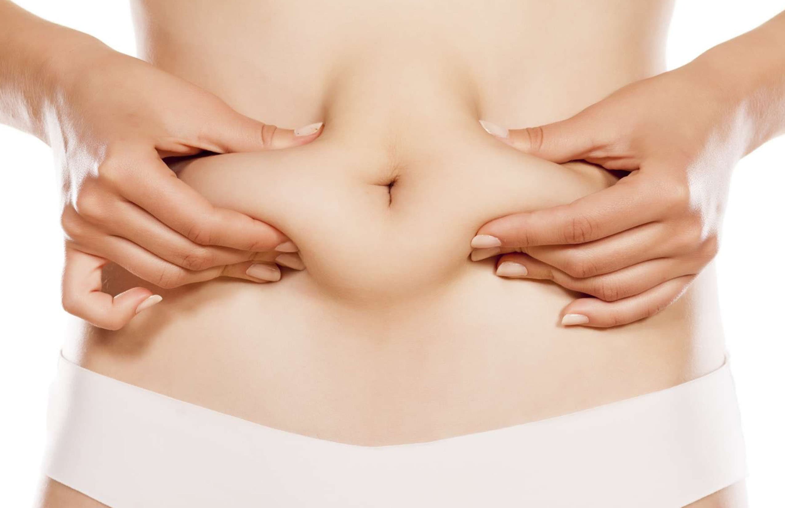 Tummy Tuck in Chihuahua
