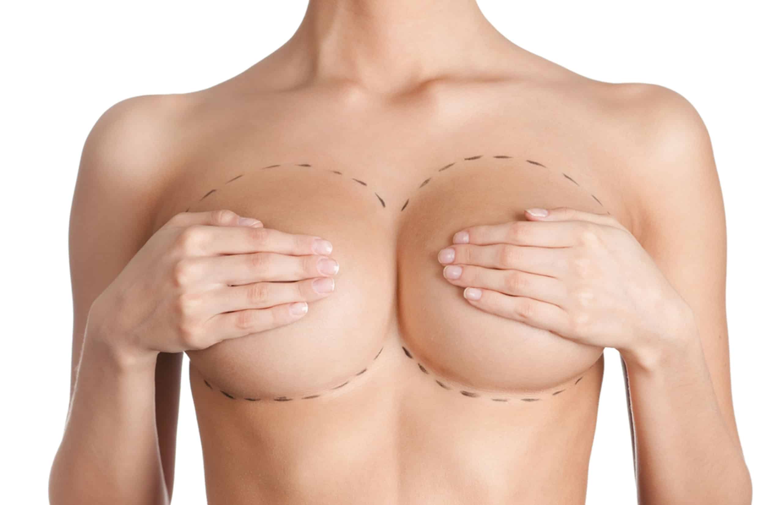 Breast Augmentation in Chihuahua