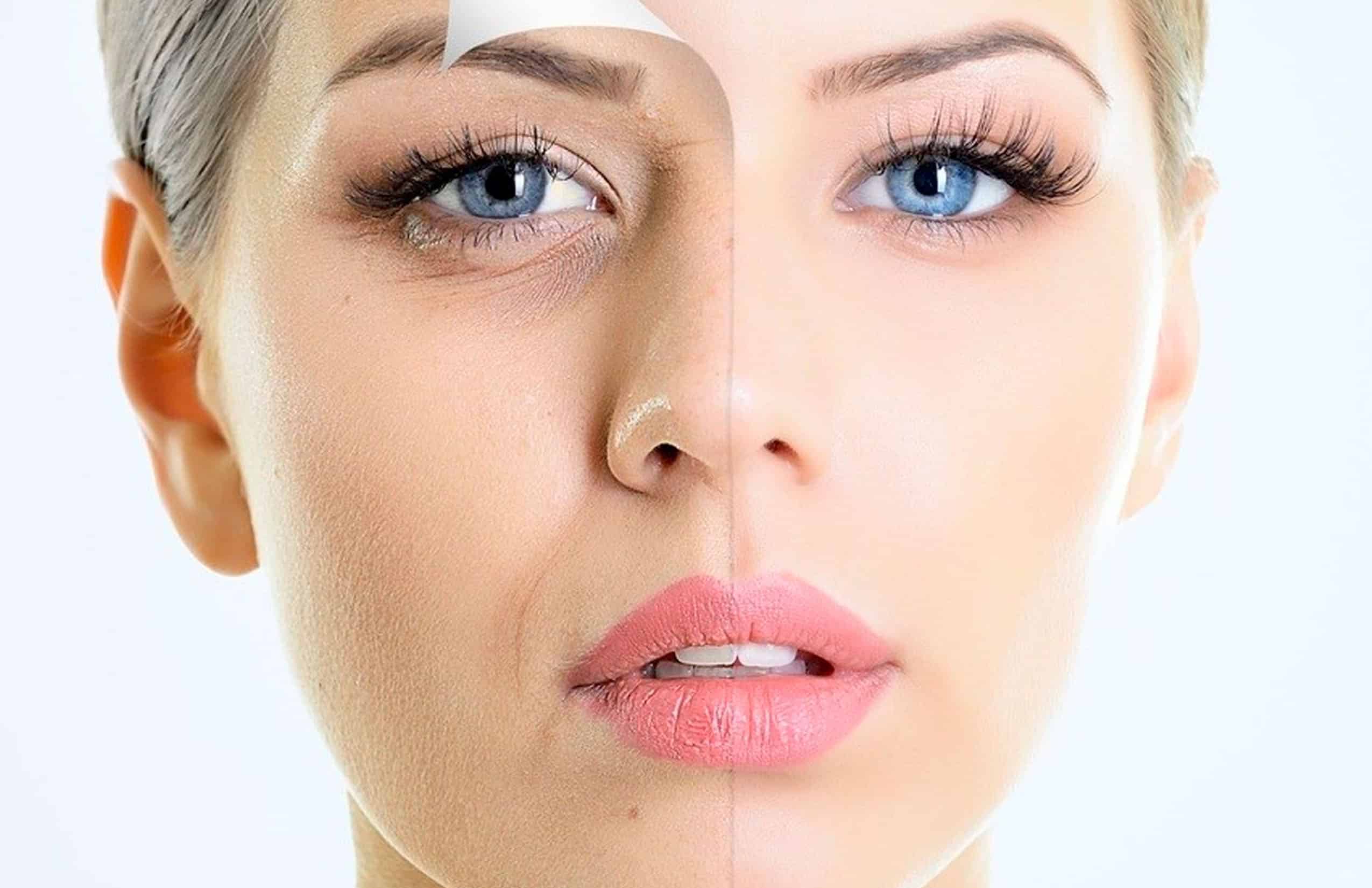 Platelet-Rich Plasma in Chihuahua