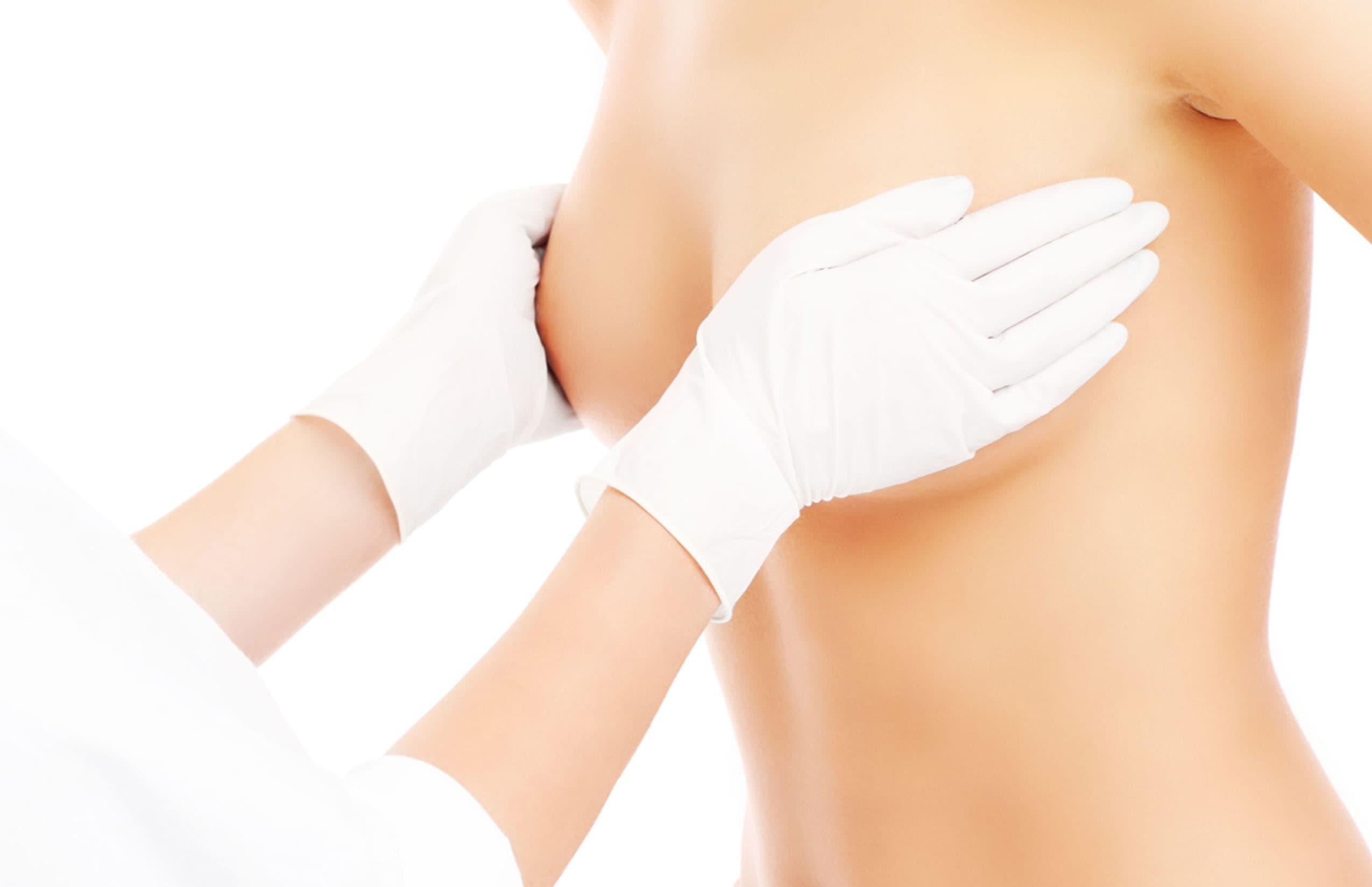 Breast Reduction in Chihuahua